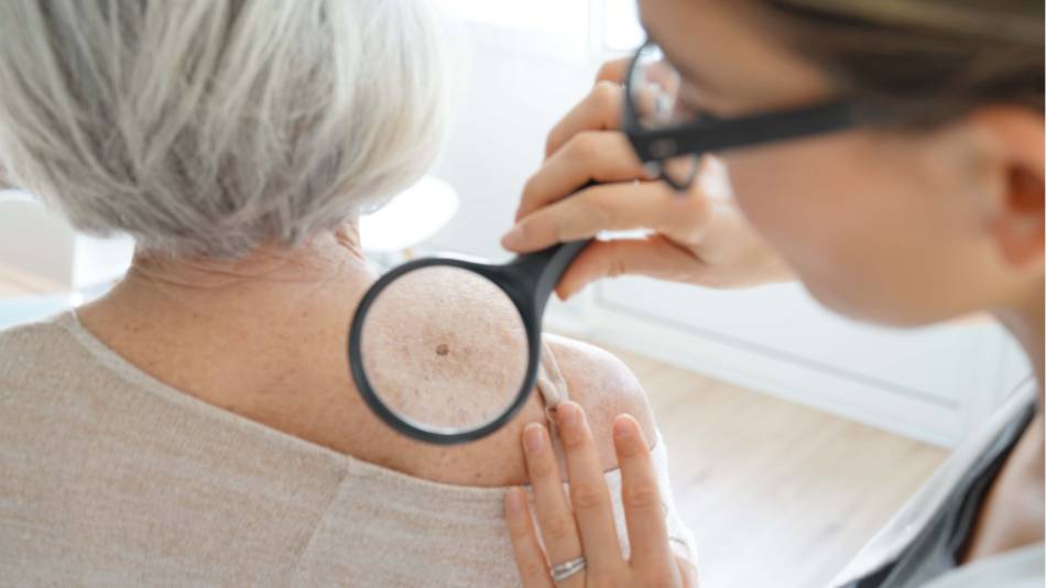 Dermatologist examining the skin on the back of an older woman for signs of sun damage or skin cancer