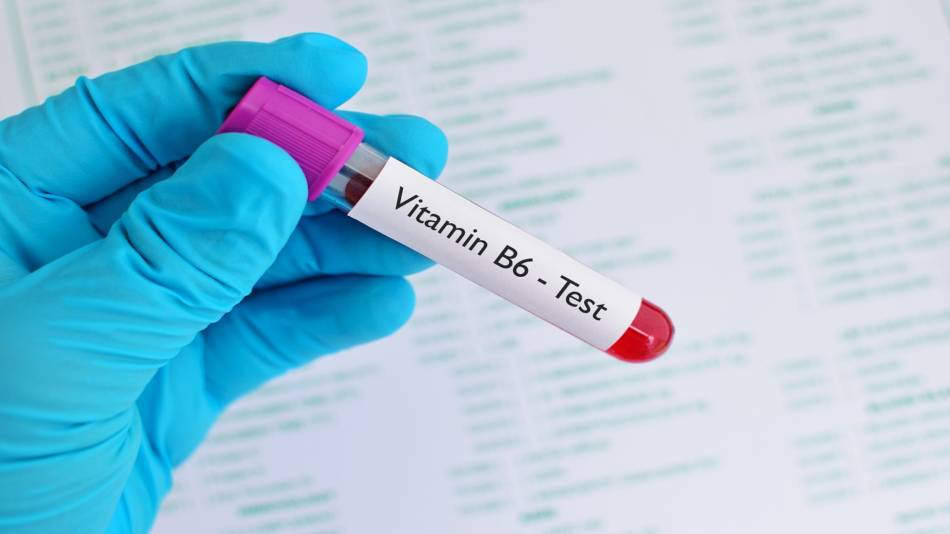 Vitamin B6 Toxicity -- Vitamin B6 Blood Test