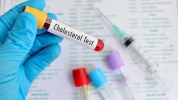 Cholesterol