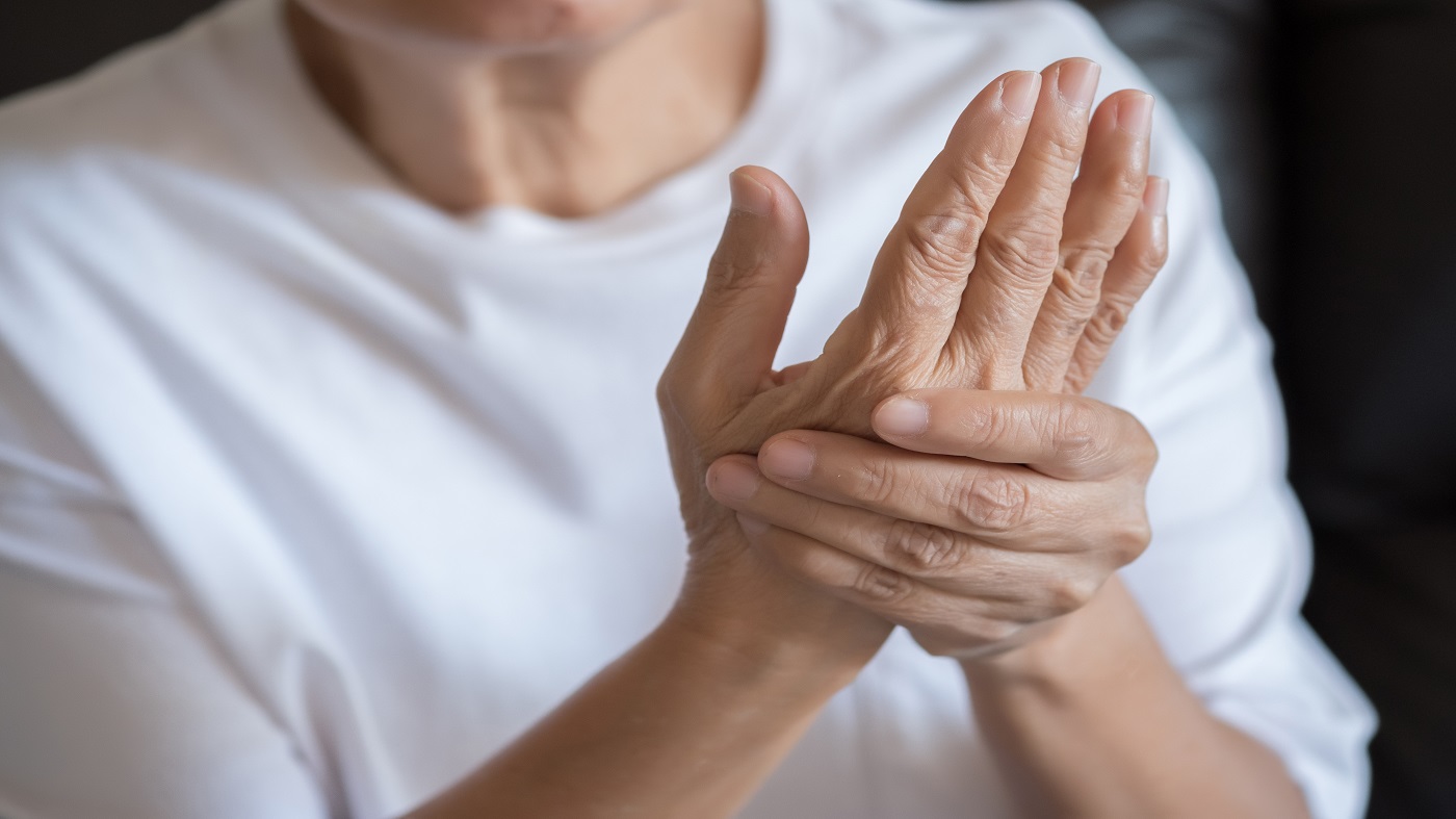 Supplements for Osteoarthritis and Rheumatoid Arthritis -- Women With Arthritic Hands