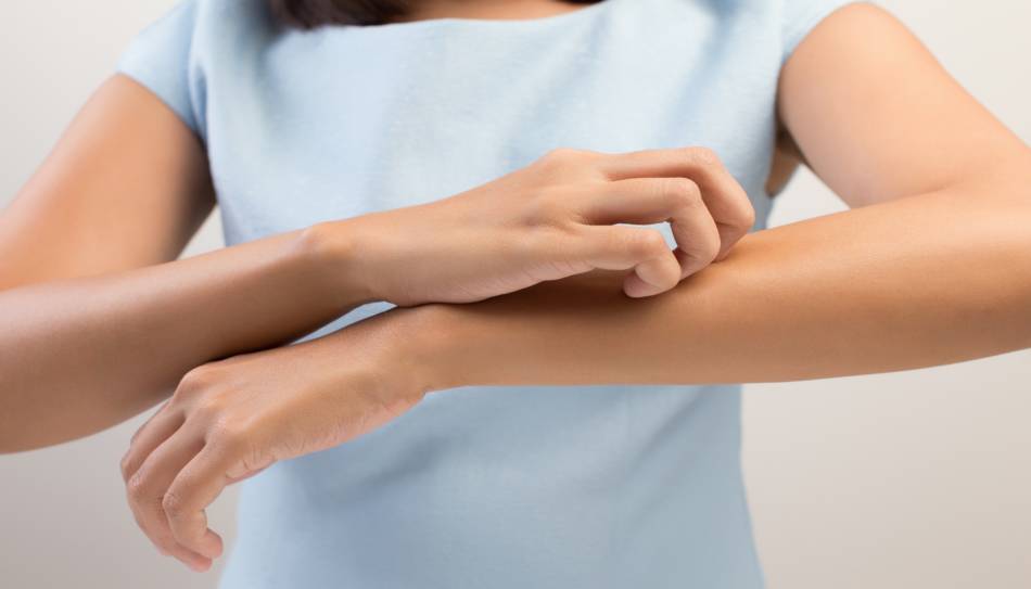 Young Woman Scratching Forearm