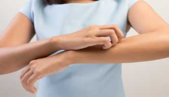 Young Woman Scratching Forearm