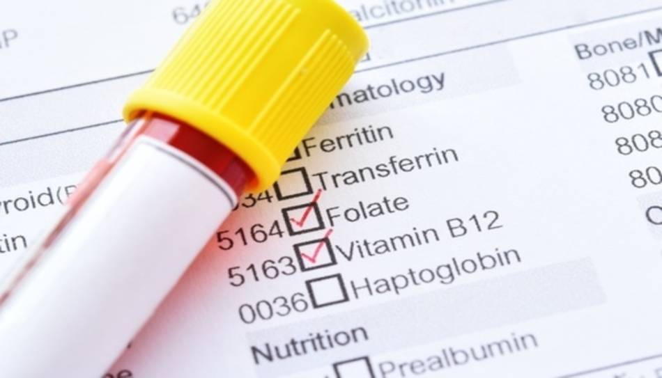 Testing for B Vitamins