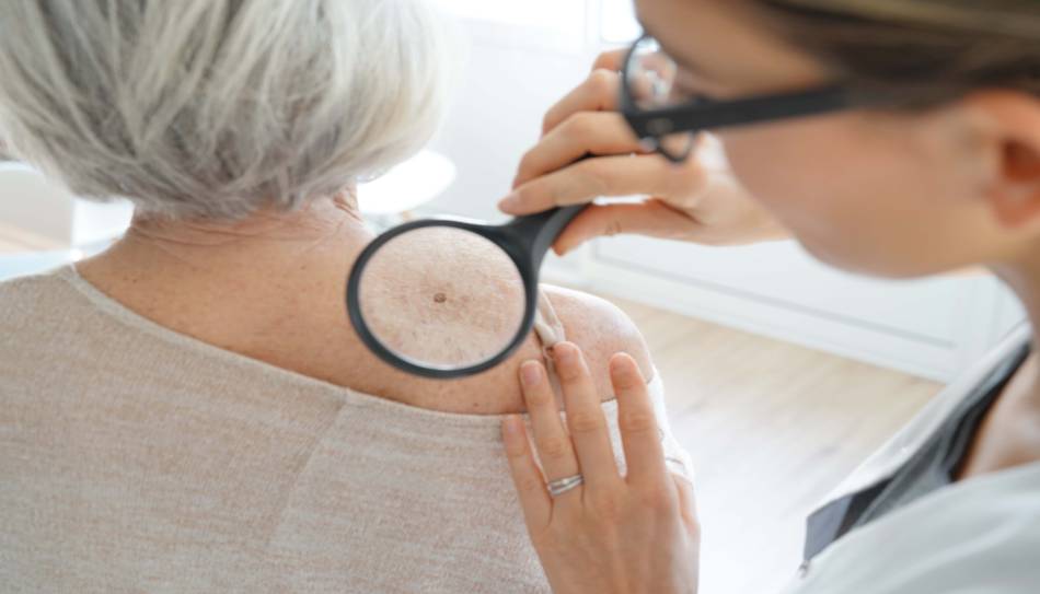 Elderly Woman Getting Mole on Back Examined By Doctor