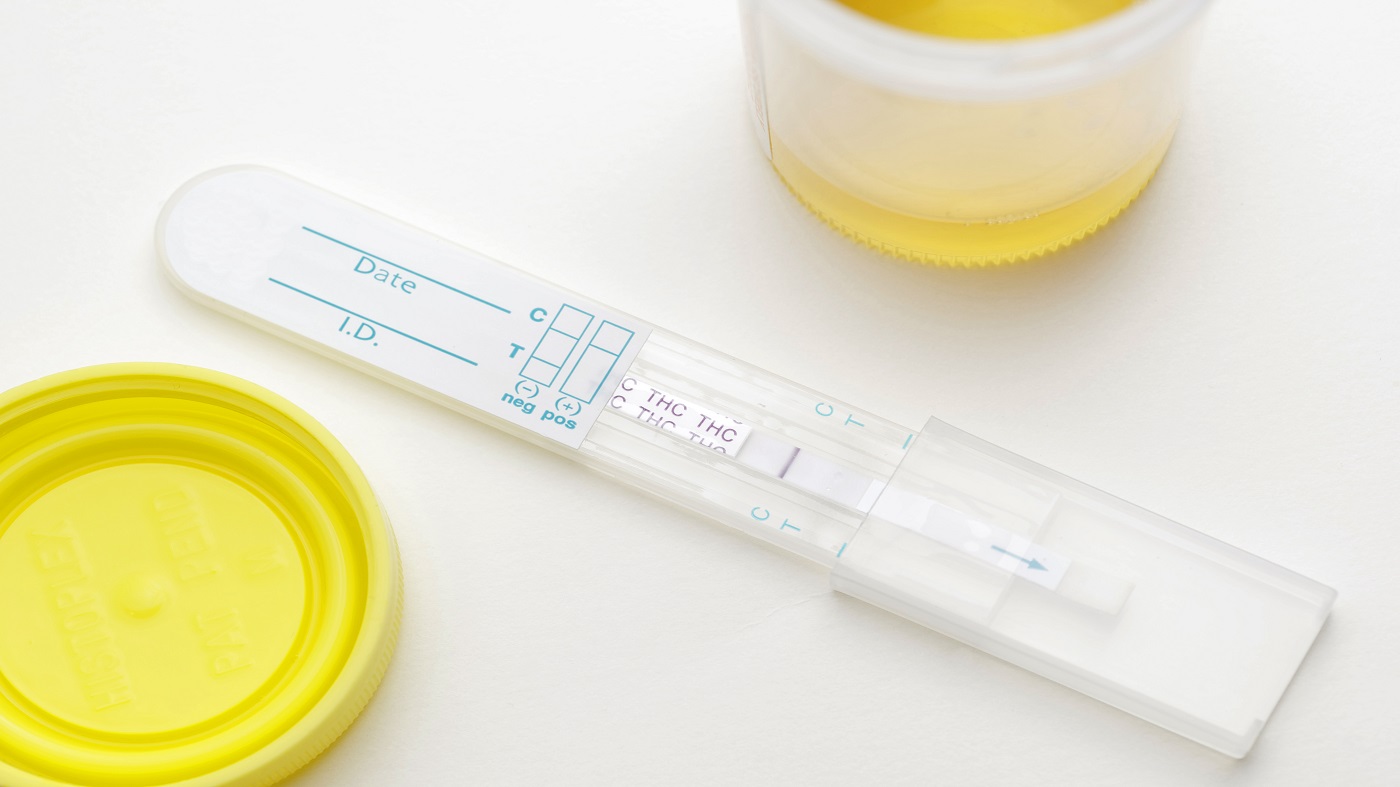 CBD Oil Causes a Failed Drug Test? -- urine sample for drug test