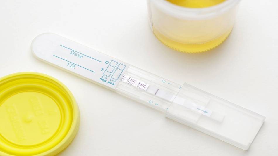 CBD Oil Causes a Failed Drug Test? -- urine sample for drug test