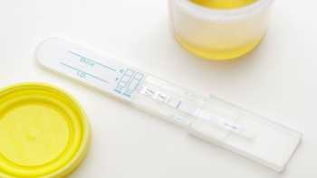 CBD Oil Causes a Failed Drug Test? -- urine sample for drug test