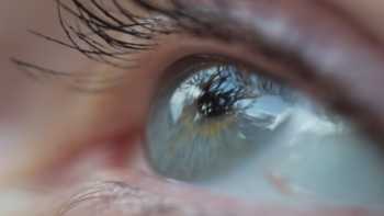 How to Reduce Eye Floaters With Vitamins & Supplements -- Close-up of an eye