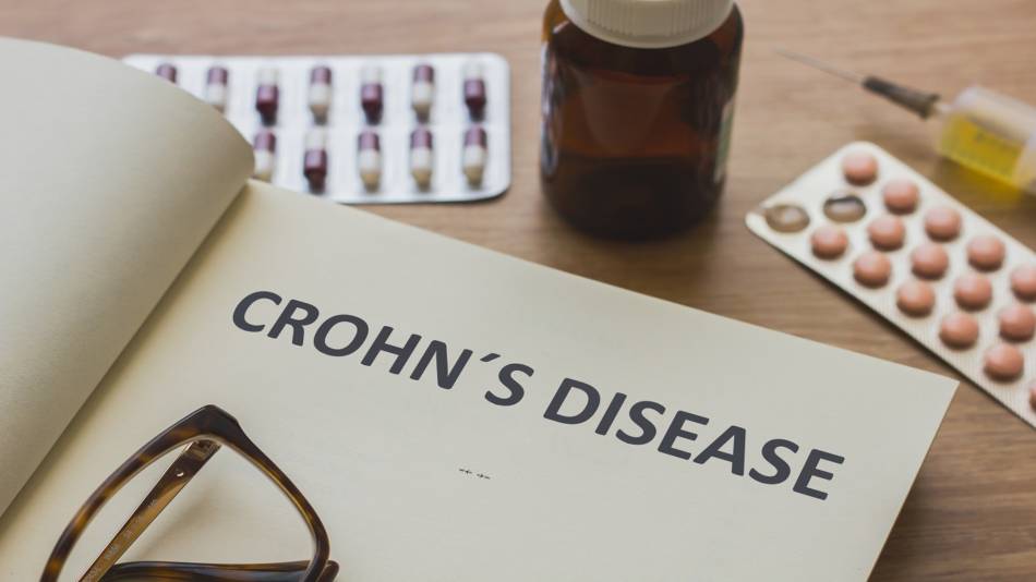 Supplements for Crohn's Disease -- Crohn's Disease Written on Notepad, Pills