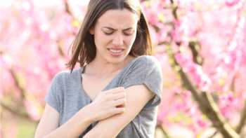 Woman in gray shirt standing outdoors and scratching her arm