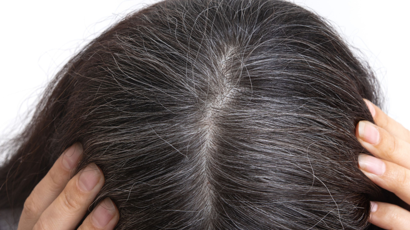 Causes of Grey Hair & Remedies to Prevent Them