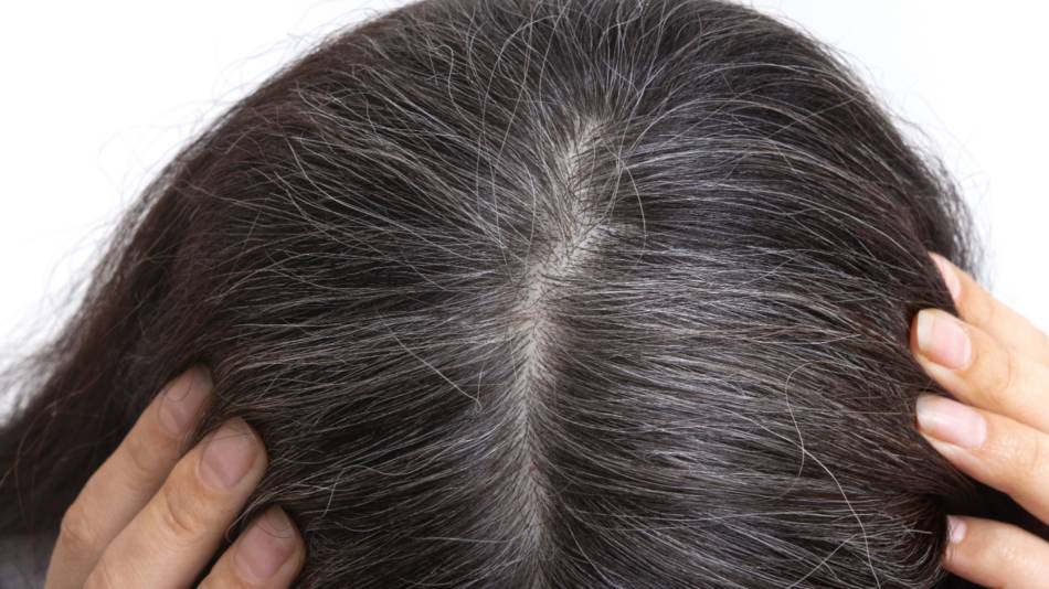 Supplement or Topicals to Reverse Gray Hair?